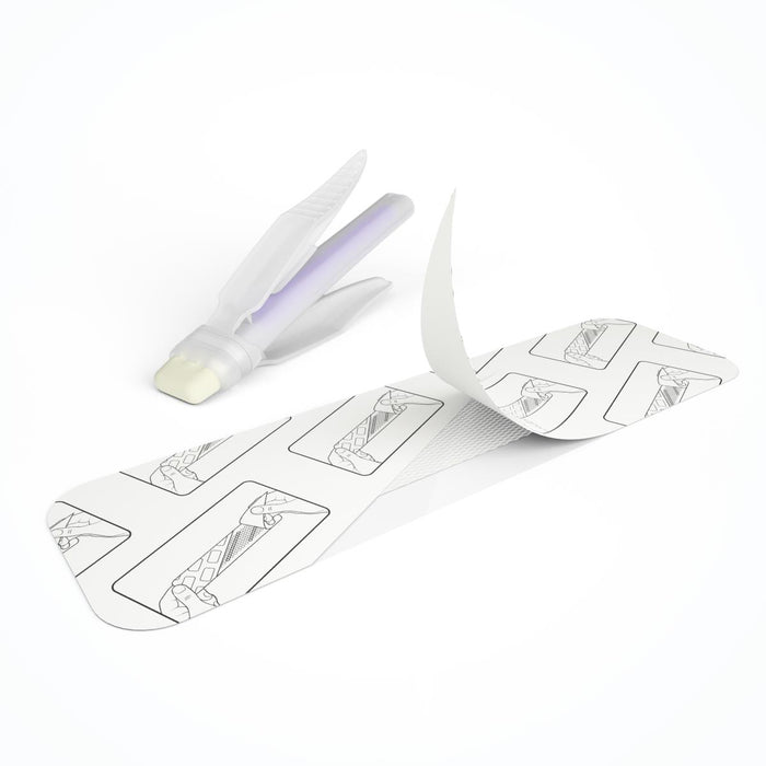 OptiClose Secure Wound Closure Device